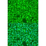 Immunofluorescence - Anti-NFkB p100/NFKB2 Antibody (A14356) - Antibodies.com
