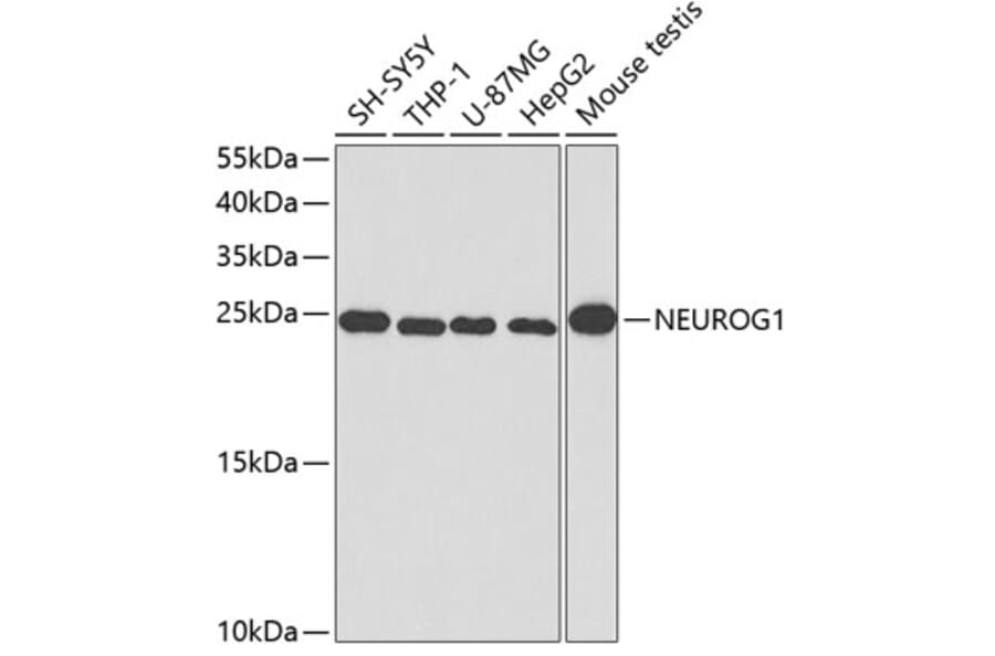 Western Blot - Anti-Neurogenin 1/NEUROG1 Antibody (A14357) - Antibodies.com
