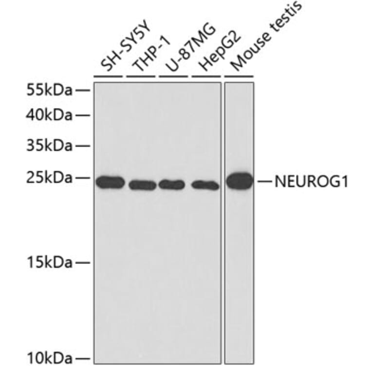 Western Blot - Anti-Neurogenin 1/NEUROG1 Antibody (A14357) - Antibodies.com
