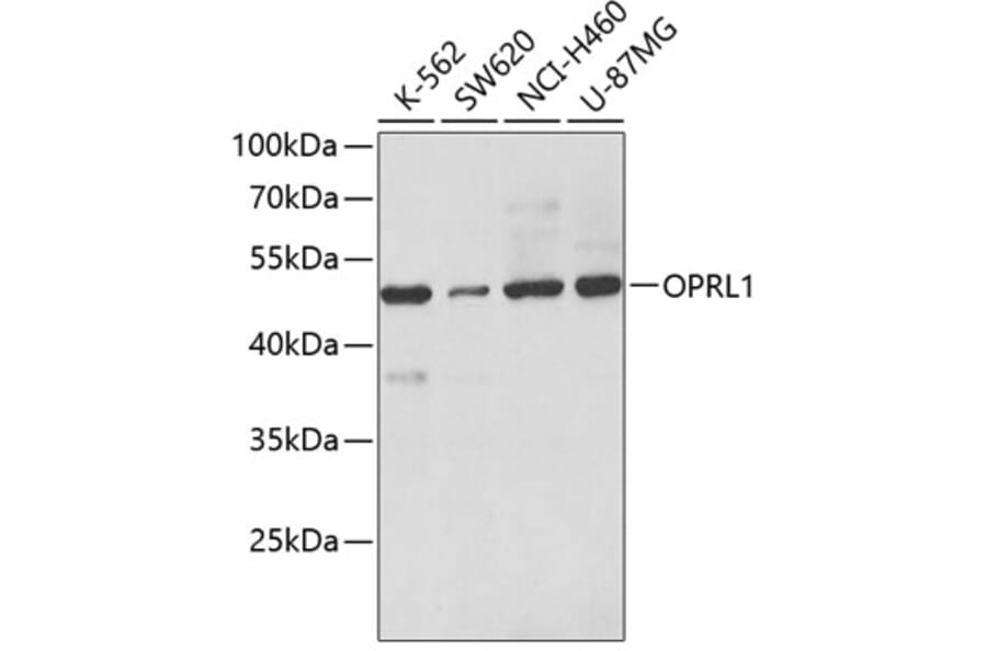 Western Blot - Anti-Nociceptin receptor Antibody (A14358) - Antibodies.com