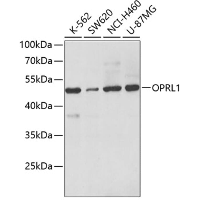 Western Blot - Anti-Nociceptin receptor Antibody (A14358) - Antibodies.com