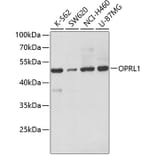 Western Blot - Anti-Nociceptin receptor Antibody (A14358) - Antibodies.com