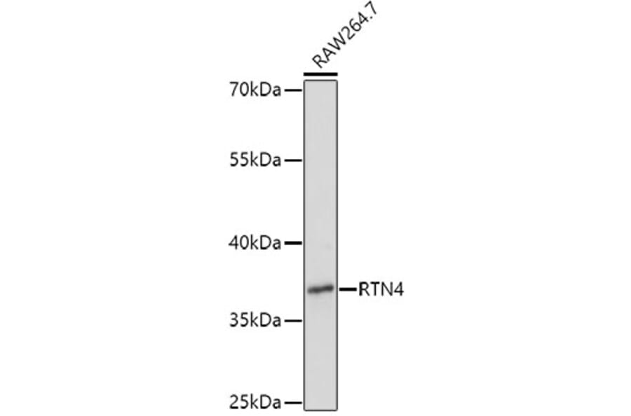 Western Blot - Anti-RTN4 Antibody (A3114) - Antibodies.com