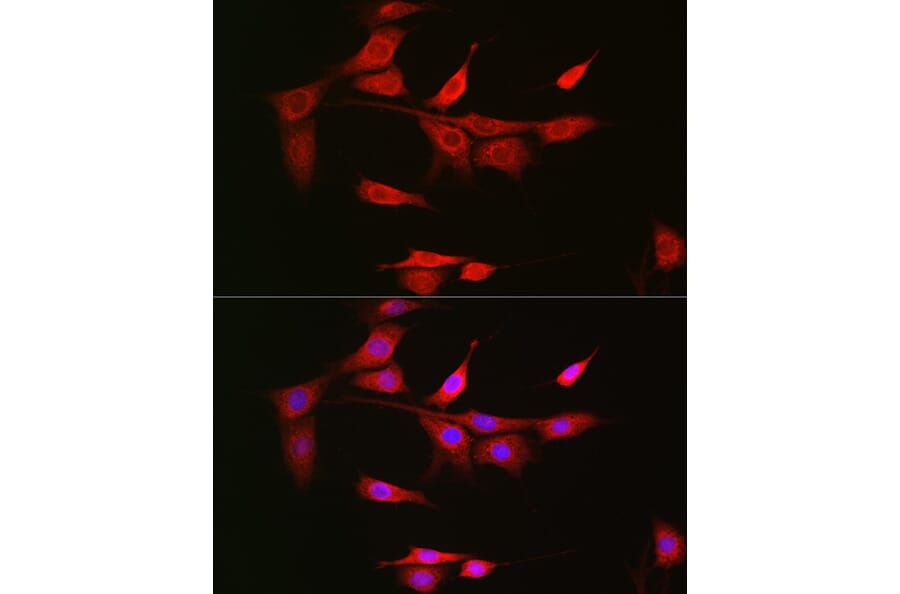 Immunofluorescence - Anti-NOTCH3 Antibody (A14360) - Antibodies.com