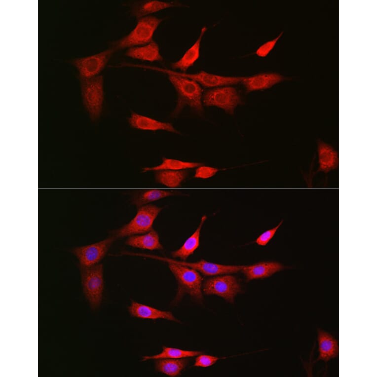 Immunofluorescence - Anti-NOTCH3 Antibody (A14360) - Antibodies.com