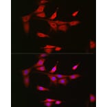 Immunofluorescence - Anti-NOTCH3 Antibody (A14360) - Antibodies.com