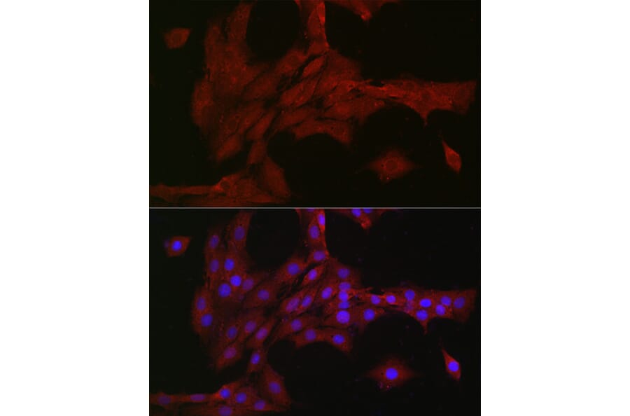 Immunofluorescence - Anti-NOTCH3 Antibody (A14360) - Antibodies.com