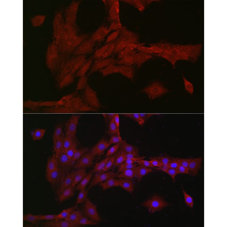 Immunofluorescence - Anti-NOTCH3 Antibody (A14360) - Antibodies.com
