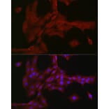 Immunofluorescence - Anti-NOTCH3 Antibody (A14360) - Antibodies.com