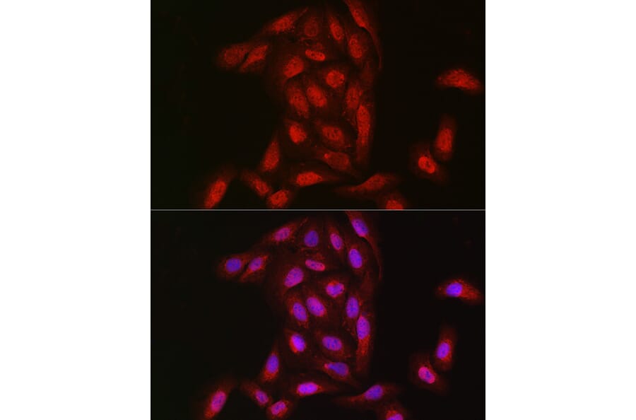 Immunofluorescence - Anti-NOTCH3 Antibody (A14360) - Antibodies.com