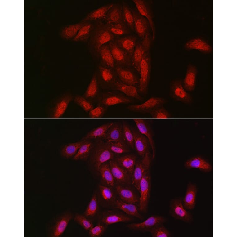 Immunofluorescence - Anti-NOTCH3 Antibody (A14360) - Antibodies.com