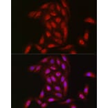 Immunofluorescence - Anti-NOTCH3 Antibody (A14360) - Antibodies.com