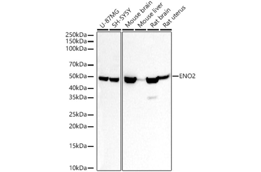Western Blot - Anti-NSE/ENO2 Antibody (A14361) - Antibodies.com