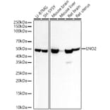 Western Blot - Anti-NSE/ENO2 Antibody (A14361) - Antibodies.com