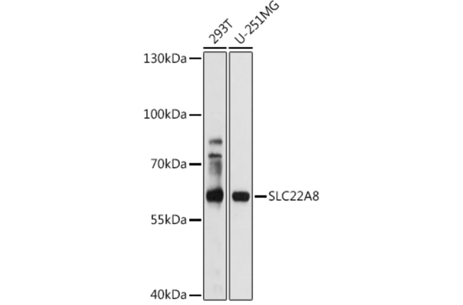 Western Blot - Anti-OAT3 Antibody (A14362) - Antibodies.com