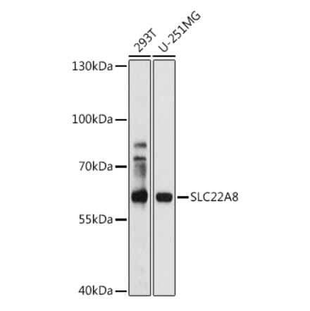 Western Blot - Anti-OAT3 Antibody (A14362) - Antibodies.com