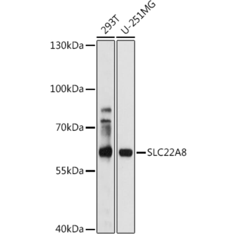 Western Blot - Anti-OAT3 Antibody (A14362) - Antibodies.com