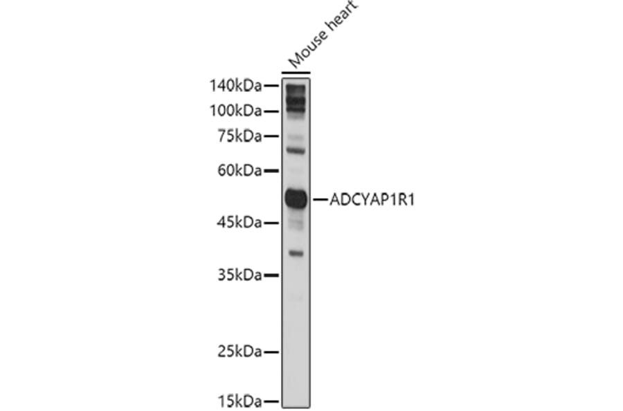 Western Blot - Anti-PACAP receptor/ADCYAP1R1 Antibody (A14363) - Antibodies.com