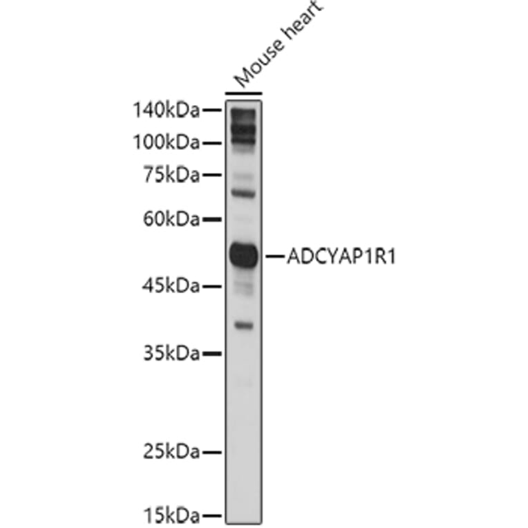 Western Blot - Anti-PACAP receptor/ADCYAP1R1 Antibody (A14363) - Antibodies.com