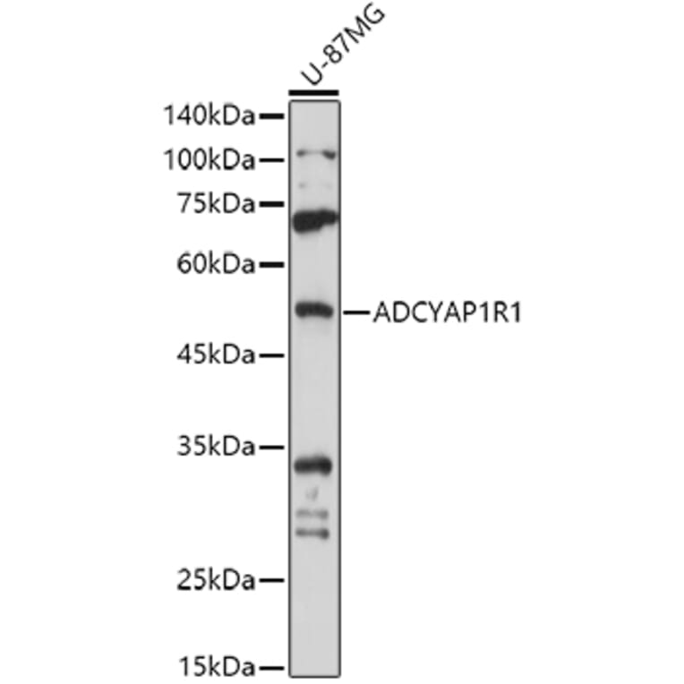 Western Blot - Anti-PACAP receptor/ADCYAP1R1 Antibody (A14363) - Antibodies.com