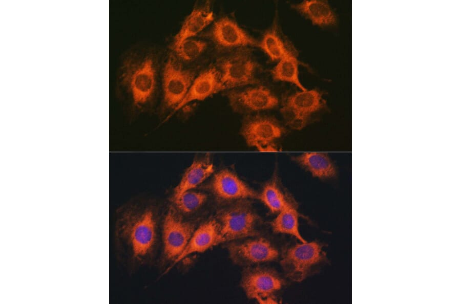 Immunofluorescence - Anti-PACAP receptor/ADCYAP1R1 Antibody (A14363) - Antibodies.com
