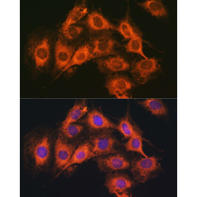 Immunofluorescence - Anti-PACAP receptor/ADCYAP1R1 Antibody (A14363) - Antibodies.com