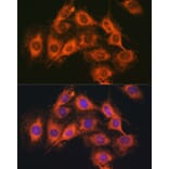 Immunofluorescence - Anti-PACAP receptor/ADCYAP1R1 Antibody (A14363) - Antibodies.com