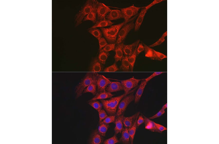 Immunofluorescence - Anti-PACAP receptor/ADCYAP1R1 Antibody (A14363) - Antibodies.com