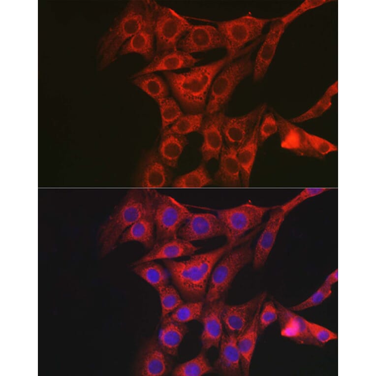 Immunofluorescence - Anti-PACAP receptor/ADCYAP1R1 Antibody (A14363) - Antibodies.com