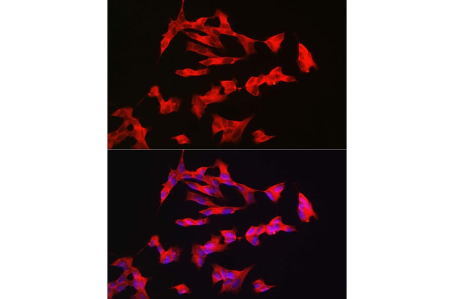 Immunofluorescence - Anti-PACAP receptor/ADCYAP1R1 Antibody (A14363) - Antibodies.com