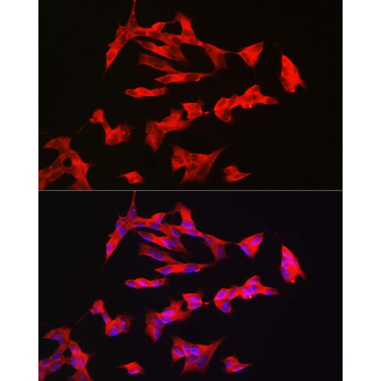 Immunofluorescence - Anti-PACAP receptor/ADCYAP1R1 Antibody (A14363) - Antibodies.com