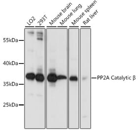 Western Blot - Anti-PPP2CB Antibody (A14364) - Antibodies.com