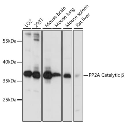 Western Blot - Anti-PPP2CB Antibody (A14364) - Antibodies.com