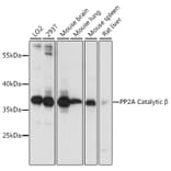 Western Blot - Anti-PPP2CB Antibody (A14364) - Antibodies.com