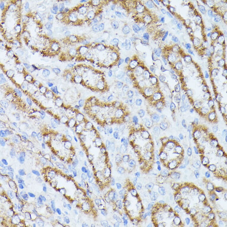 Immunohistochemistry - Anti-PPP2CB Antibody (A14364) - Antibodies.com