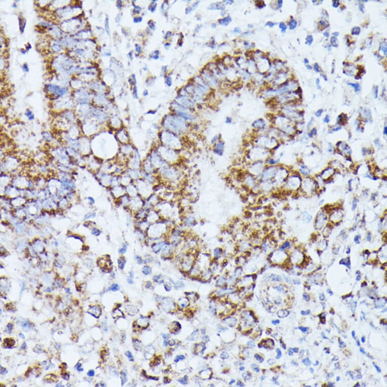 Immunohistochemistry - Anti-PPP2CB Antibody (A14364) - Antibodies.com