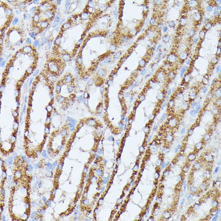 Immunohistochemistry - Anti-PPP2CB Antibody (A14364) - Antibodies.com