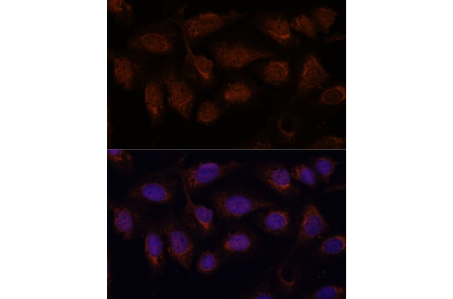 Immunofluorescence - Anti-PPP2CB Antibody (A14364) - Antibodies.com