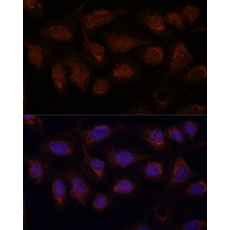 Immunofluorescence - Anti-PPP2CB Antibody (A14364) - Antibodies.com
