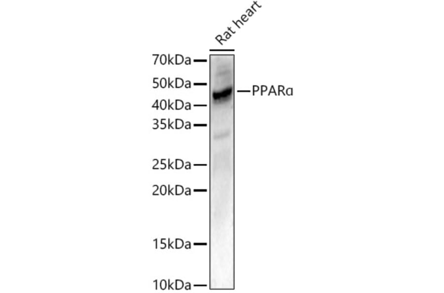Western Blot - Anti-PPAR alpha Antibody (A14365) - Antibodies.com