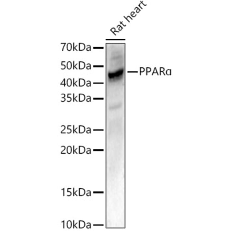 Western Blot - Anti-PPAR alpha Antibody (A14365) - Antibodies.com