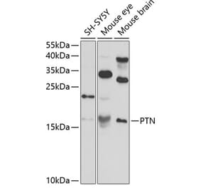 Western Blot - Anti-PTN Antibody (A14366) - Antibodies.com