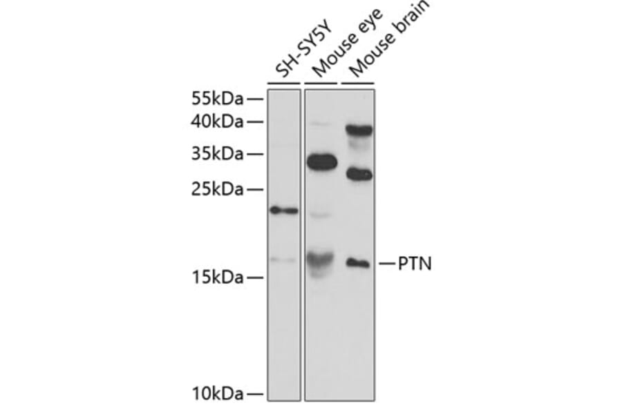 Western Blot - Anti-PTN Antibody (A14366) - Antibodies.com
