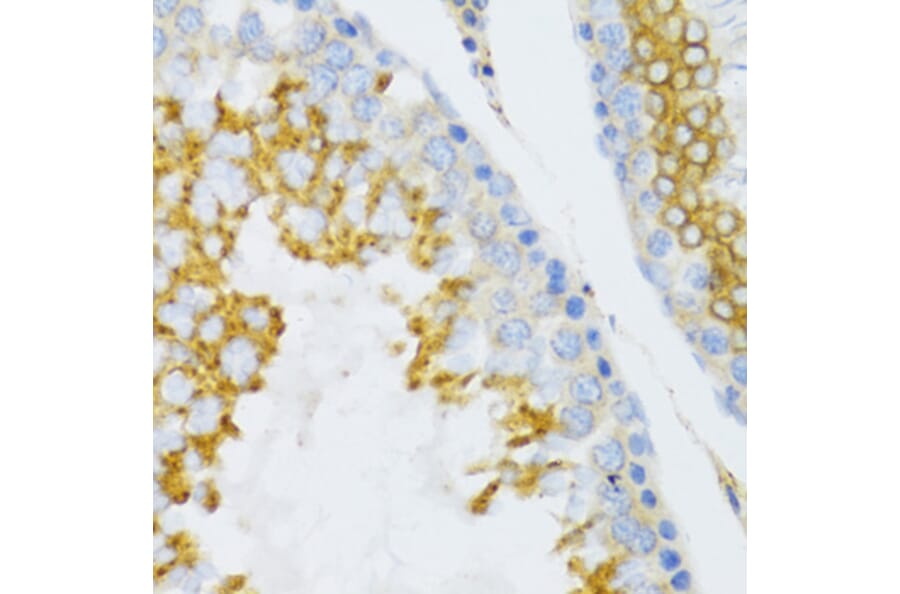 Immunohistochemistry - Anti-PTN Antibody (A14366) - Antibodies.com