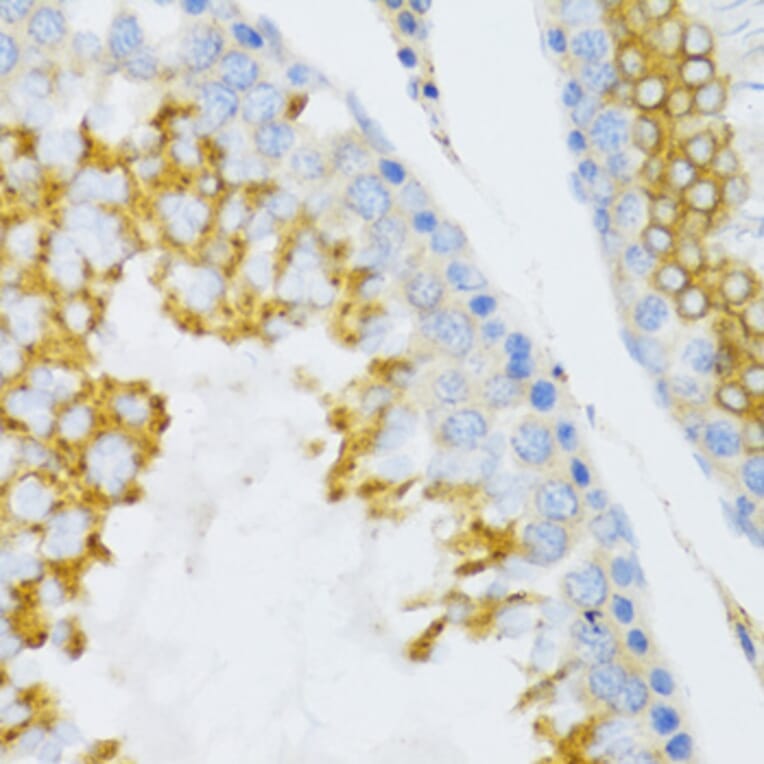 Immunohistochemistry - Anti-PTN Antibody (A14366) - Antibodies.com