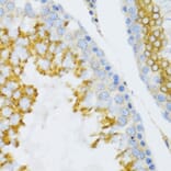 Immunohistochemistry - Anti-PTN Antibody (A14366) - Antibodies.com