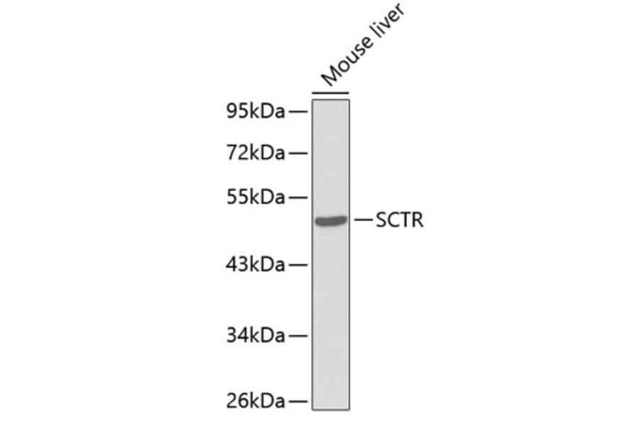 Western Blot - Anti-Secretin receptor/SCTR Antibody (A14367) - Antibodies.com