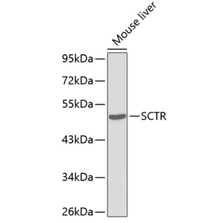 Western Blot - Anti-Secretin receptor/SCTR Antibody (A14367) - Antibodies.com