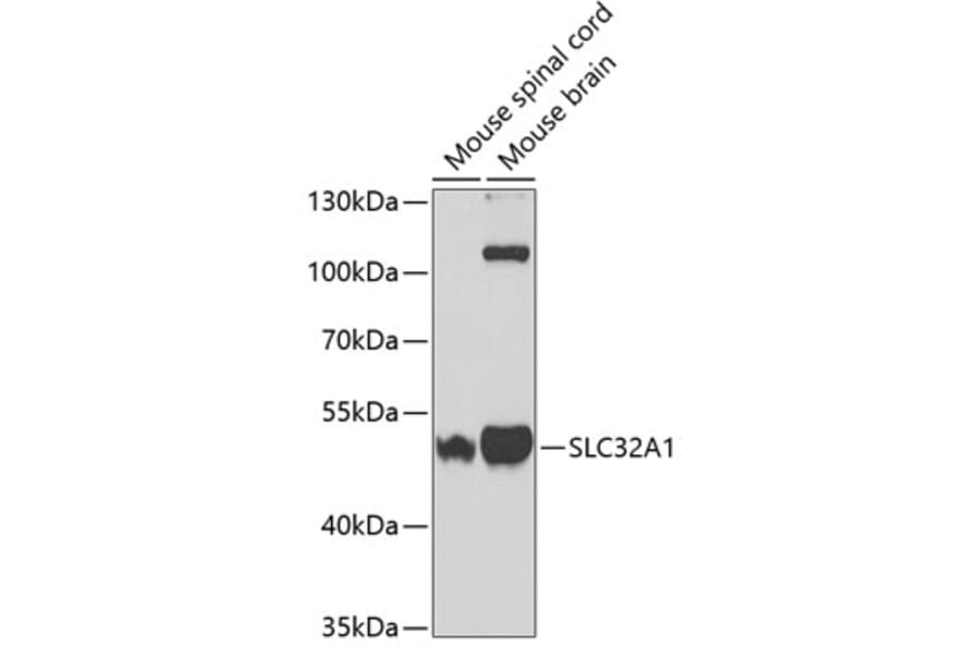 Western Blot - Anti-SLC32A1/VGAT Antibody (A14369) - Antibodies.com