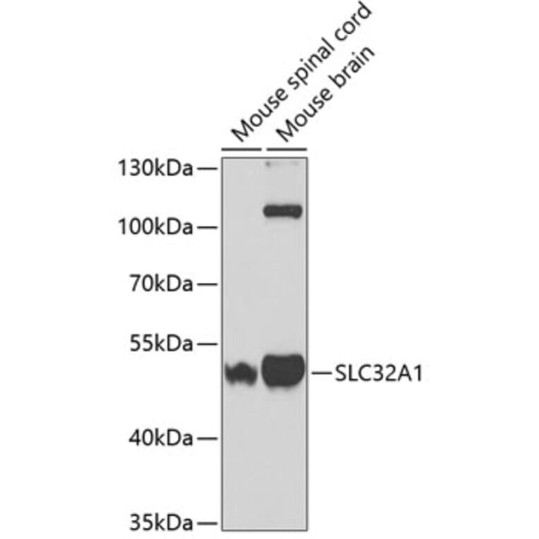 Western Blot - Anti-SLC32A1/VGAT Antibody (A14369) - Antibodies.com